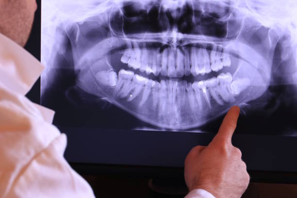 Best Emergency Dental Care for Abscessed Tooth in Greenbriar, FL