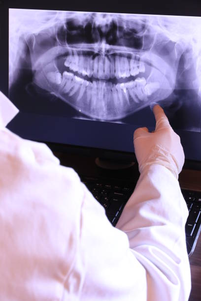 Best Emergency Root Canal Treatment in Greenbriar, FL
