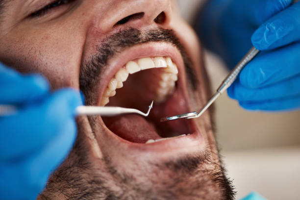Best Emergency Dental Care for Abscessed Tooth in Greenbriar, FL