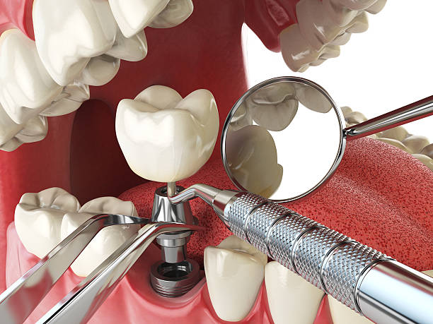 Best Pediatric Emergency Dentist in Greenbriar, FL